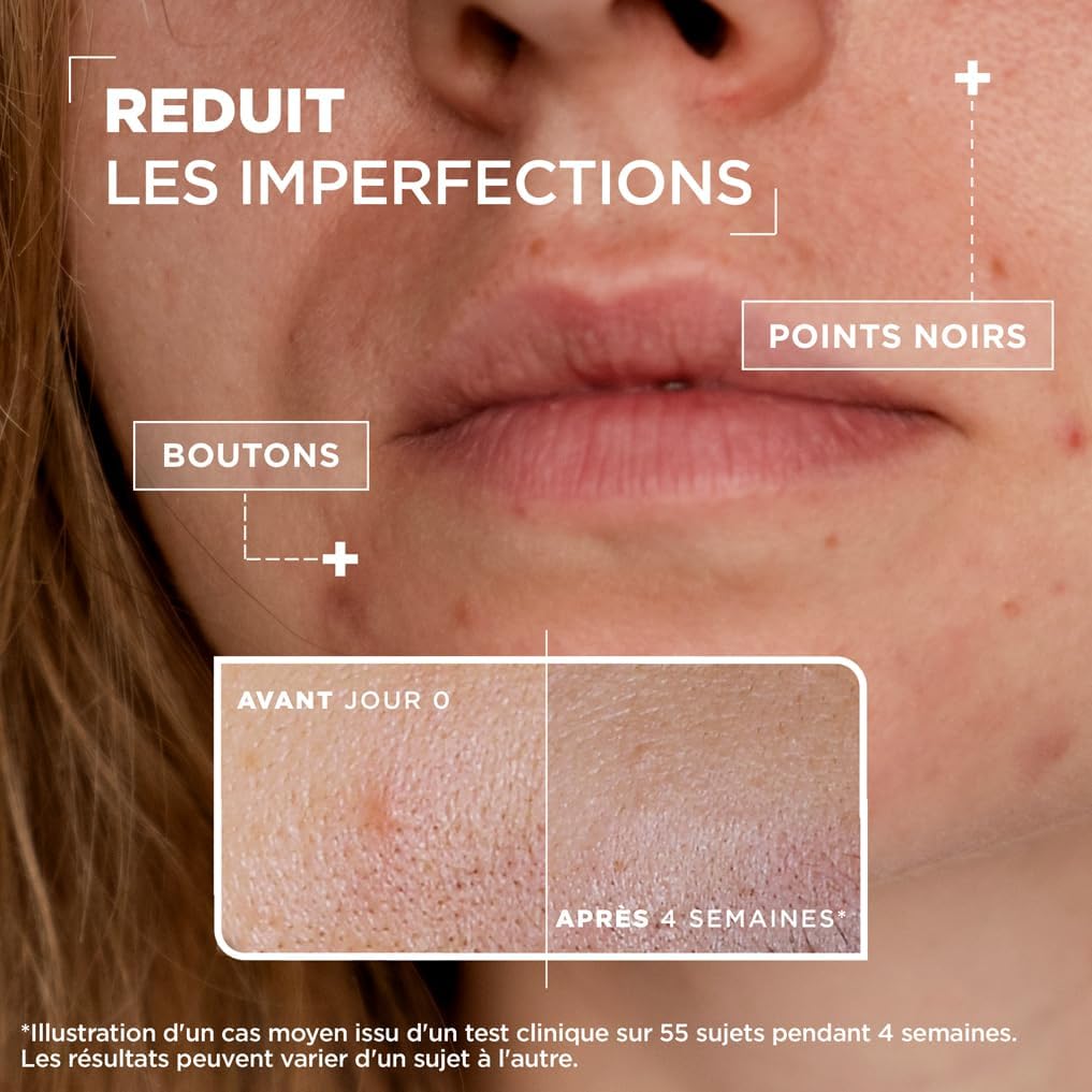 Mixa - Sérum Concentré Anti-Imperfections - Pour peaux à imperfections - Enrichi en Acide Salicylique et Niacinamide - 30 ml