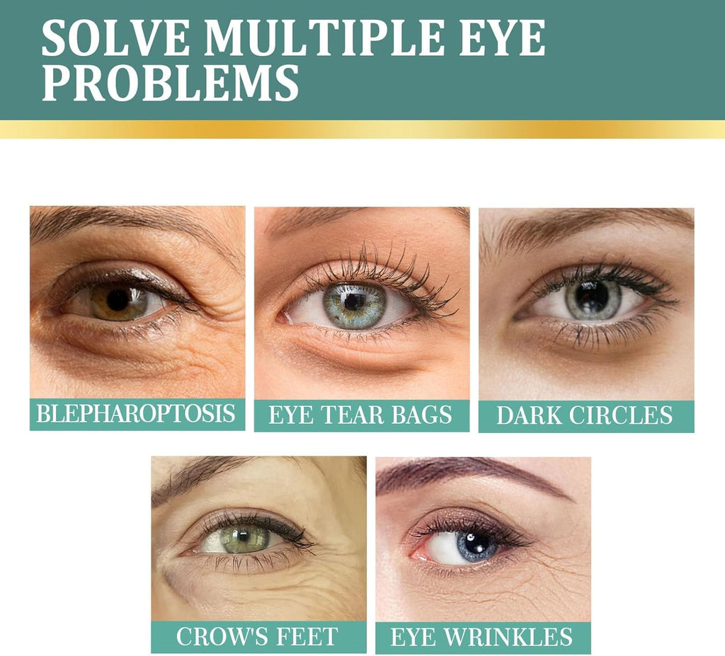 Pommade au jasmin contre les cernes sous les yeux, anti-rides, pommade au jasmin contre les cernes, pommade au jasmin contre les cernes, 100 ml, kit de soin du visage pour adolescents (blanc, taille